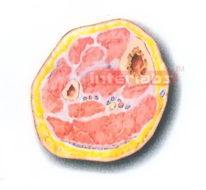 HUMAN TRANSVERSE SECTION MODEL THROUGH THE DISTAL 1/3 OF THE RIGHT LEG (C)